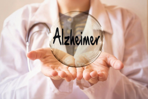 Alzheimer's